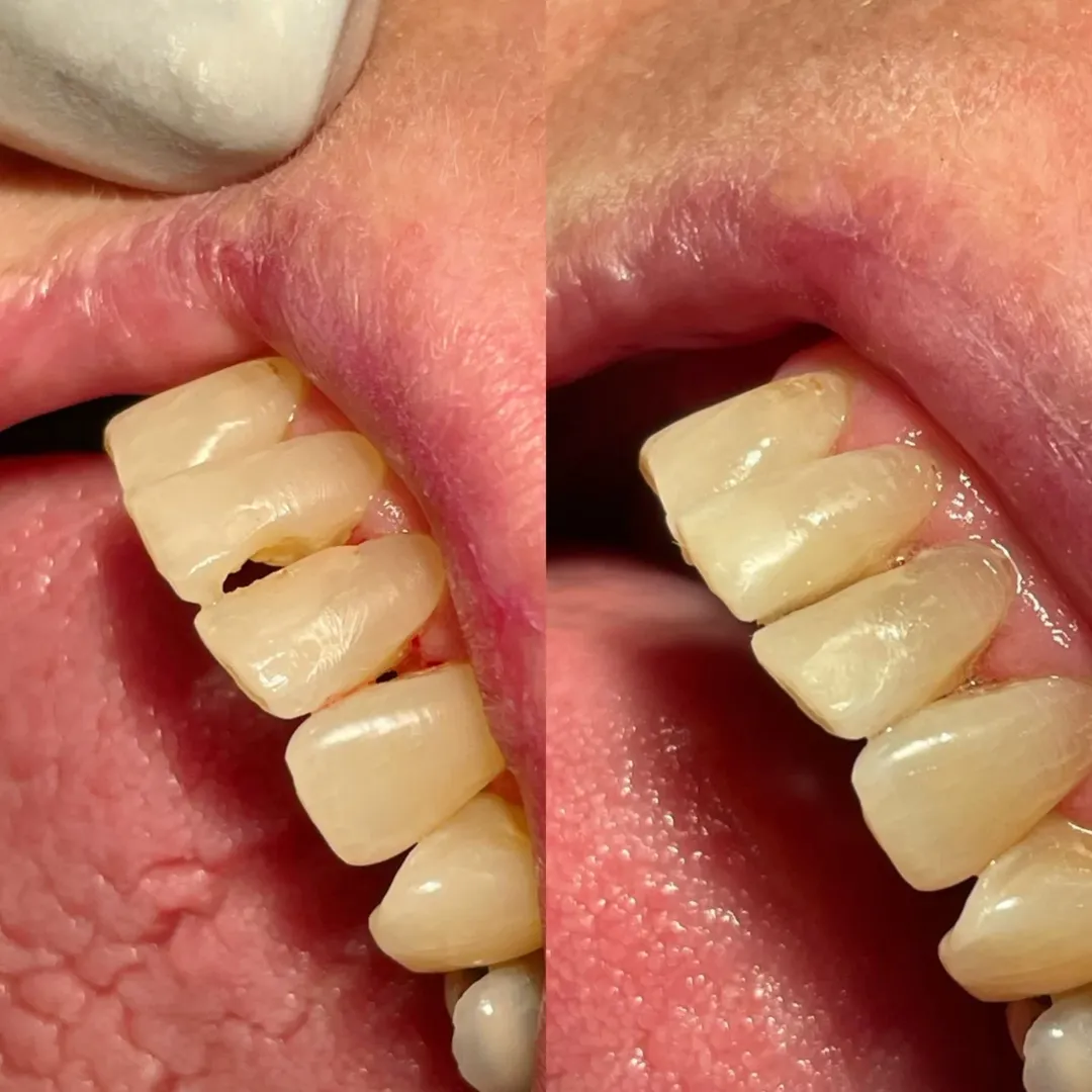 Antes e Depois 7